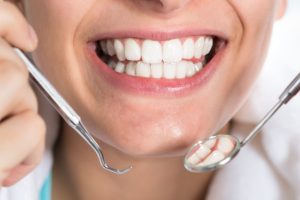 сколько стоит нарастить эмаль зубов