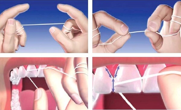 правила использования нити для зубов