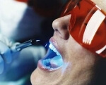 отзывы лазерное отбеливание зубов