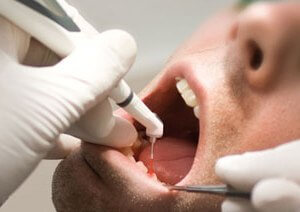 как дантист поможет пациенту со свищом