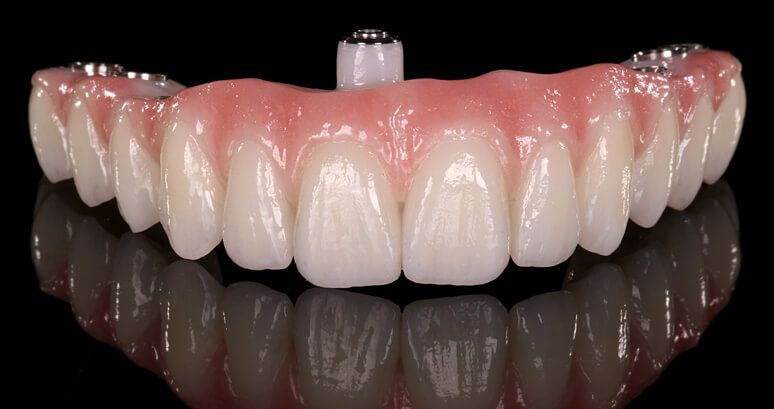 протезирование зубов в стоматологии при полном отсутствии