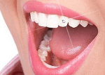 стразы на зубы фото