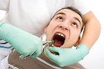 осложнения после удаления зуба