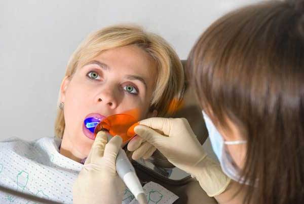 стоматологу проще работать со светоотверждаемыми зубными пломбами