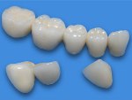 металлокерамика зубы цены