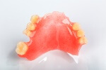 нейлоновый зубной протез цена