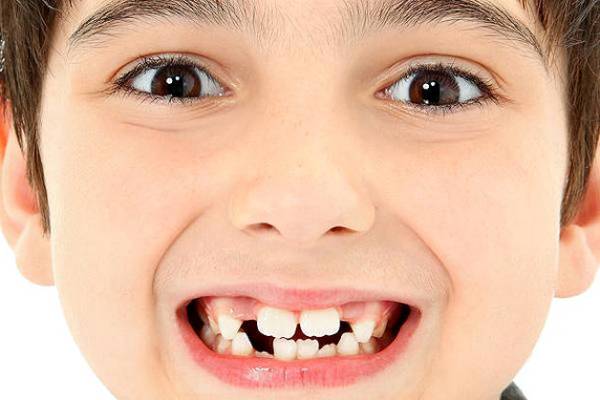 продолжительность роста постоянных зубов у ребенка