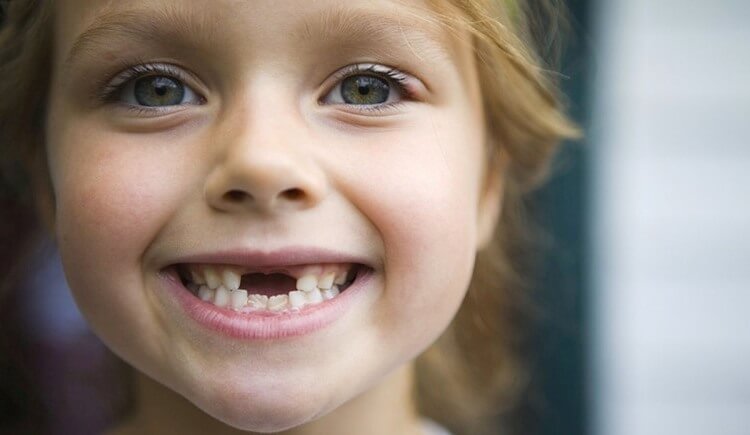 период после выпадения молочных зубов у детей