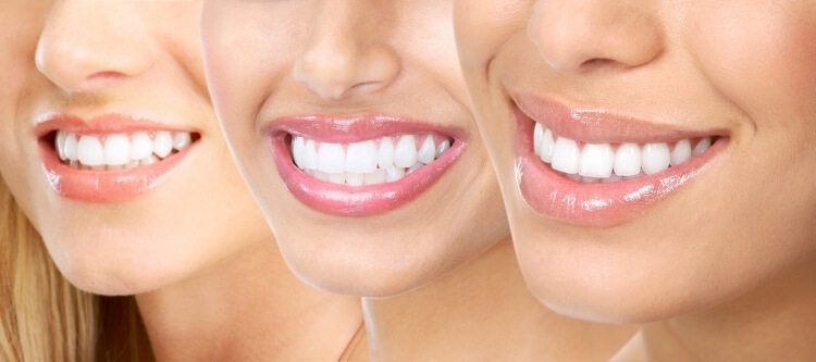 отбеливание зубов перекисью водорода отзывы людей