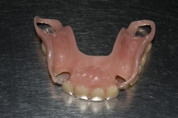что представляет собой ацеталовый зубной протез