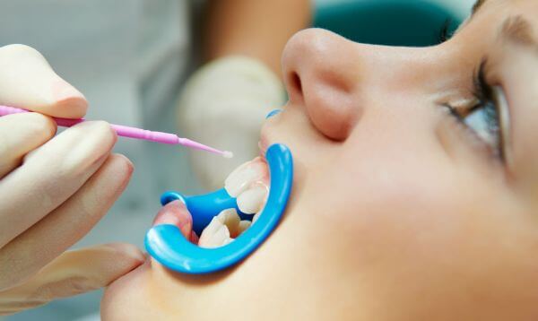 Глубокое фторирование зубов у детей