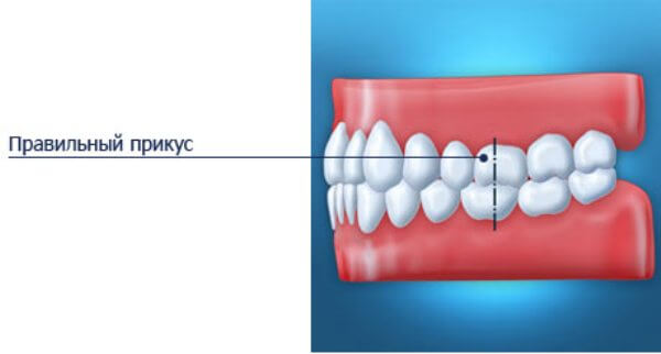 как определить правильный прикус