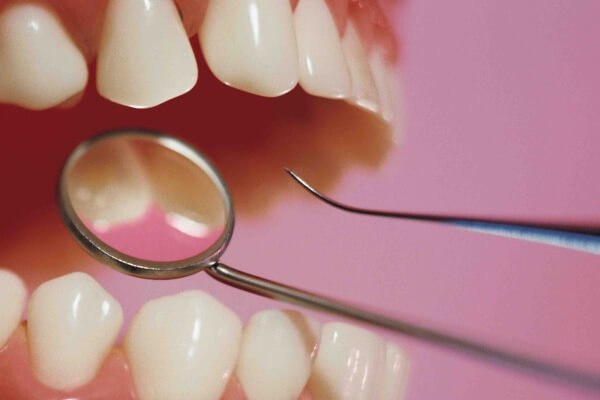методы профилактики гиперестезии зубов