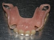 ацеталовые зубные протезы отзывы