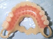 ацеталовые зубные протезы фото
