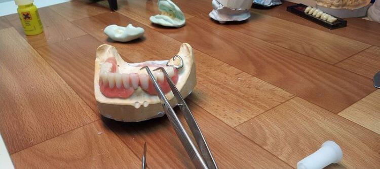 ремонт зубного протеза в стоматологии