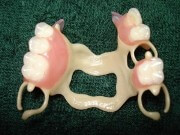 зубные протезы квадротти