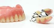 Какие съёмные зубные протезы лучше установить