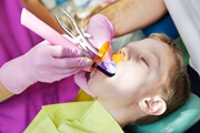 Особенности лечения циркулярного кариеса молочных зубов 