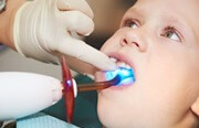 В каких случаях проводят фторирование молочных зубов у детей