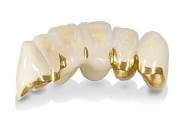 От чего зависит цена коронки на зуб из металлокерамики