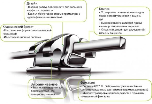 Чем выделяются брекеты Smart Clip среди аналогов