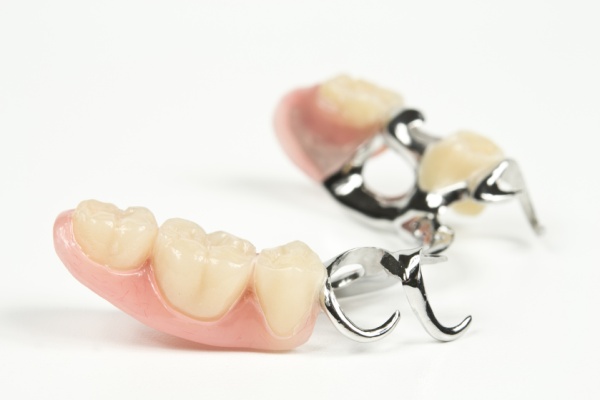 Условно съемная методика протезирования зубов