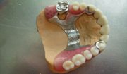 правильный уход за силиконовым материалом в стоматологии