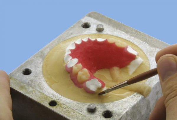 Съемный пластиночный протез при частичном отсутствии зубов фото