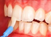 Особенности лака для зубов