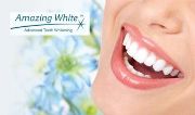 Особенности отбеливания зубов Amazing White