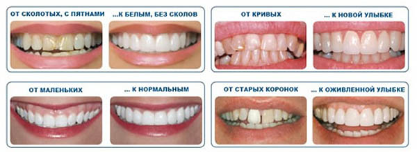 Люминиры дуо