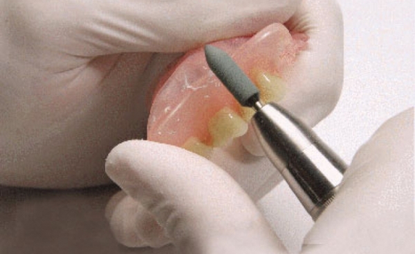 Зубные протезы полиуретановые цена