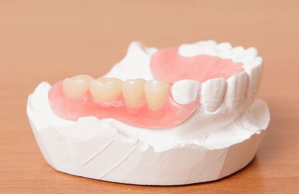 Полиуретановые зубные протезы отзывы