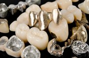 Металлы и сплавы в стоматологии