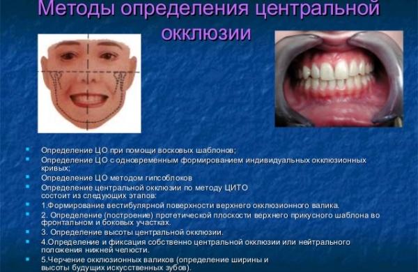 Определение центральной окклюзии при частичном отсутствии зубов