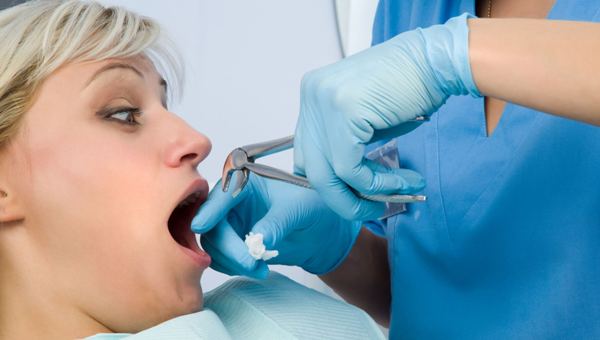 Этапы простого удаления зуба