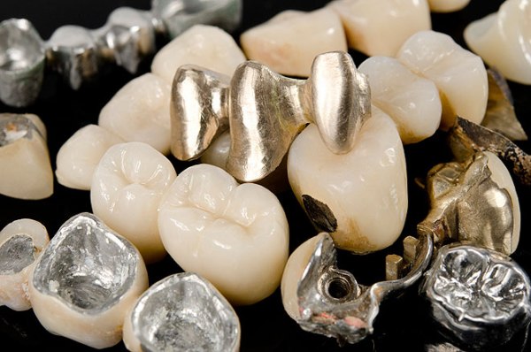 Аллергия на металл в стоматологии