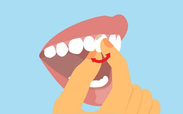 Почему шатаются зубы