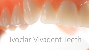 Особенности зубов Ivoclar