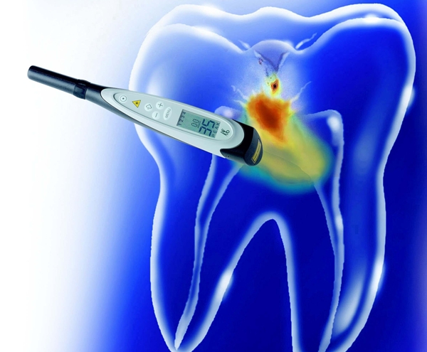Электроодонтометрия в стоматологии