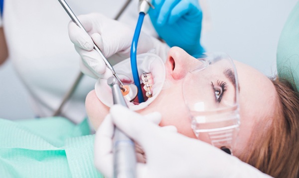 Металлические брекеты american orthodontics