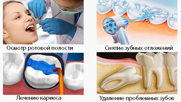 Какие анализы нужно сдать перед имплантацией зубов
