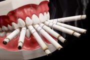 Курение после имплантации зубов