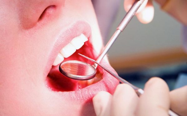 Методы диагностики начального кариеса зубов