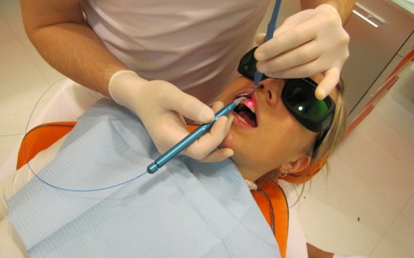 Стоимость имплантации переднего зуба