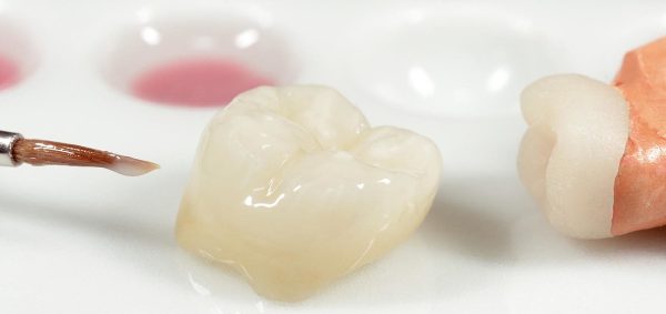Показания к восстановлению коронки зуба