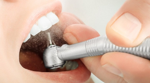 Этапы подготовки зуба