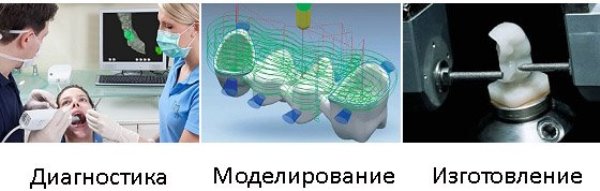 Cad cam технологии в ортопедической стоматологии