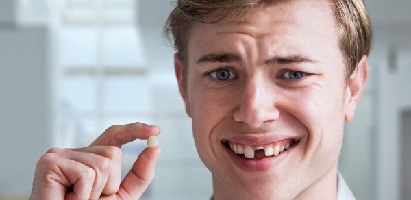Виды переломов коронки зуба и способы реставрации